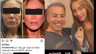 الإعلامية المصرية #ريهام_سعيد توجه اتهاماً لدكتور التجميل اللبناني #نادر_صعب بتشويه وجهها بعد خضوعها لعملية تجميل في المستشفى الخاص به وتعلق عبر صفحتها على السوشال ميديا قائلة: