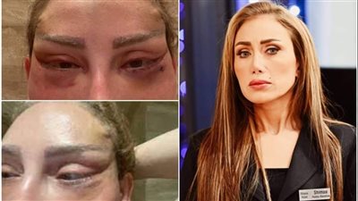 صدمة.. ريهام سعيد تتهم طبيب التجميل اللبناني