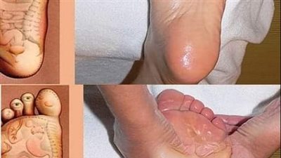 فوائد تدليك القدمين قبل النوم ستجعلك تحرص على هذه العادة يومياً