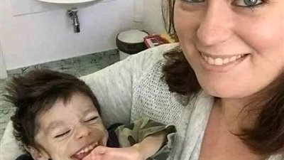 شاهد معجزة هذا الطفل المعاق بعد عامين مع سيدة أميركية